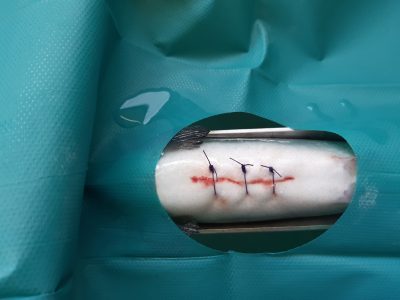 Afbeelding verwijderd.